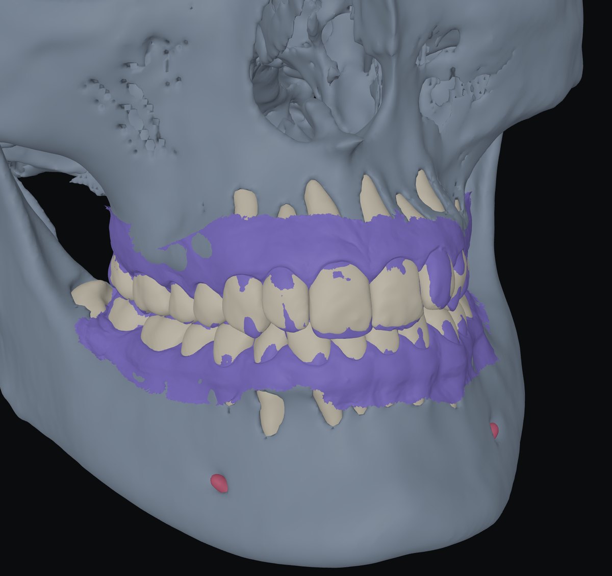 Scans land on the CT