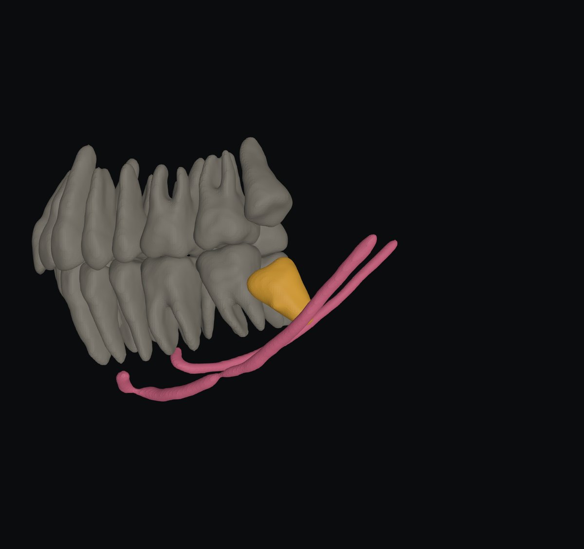 Fix, then export STL